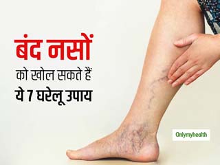 Varicose Veins:शरीर की ब्लॉक नसों को खोलने के लिए आजमाएं ये 7 घरेलू उपाय